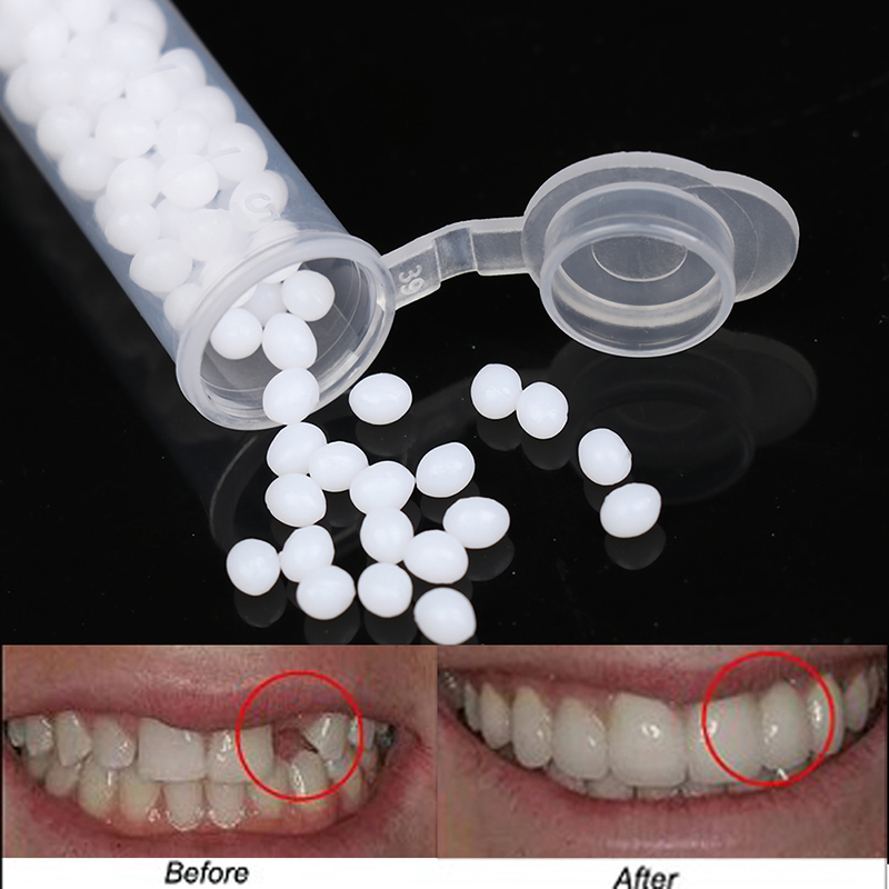 【K】1 Box temporäres Zahnrepara – Teeth Whitening Kit Bewertung und Preis